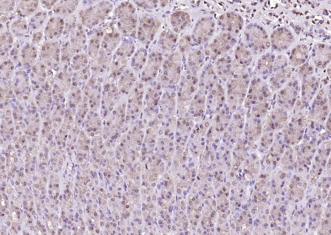 Anti-Notch 1 Polyclonal Antibody