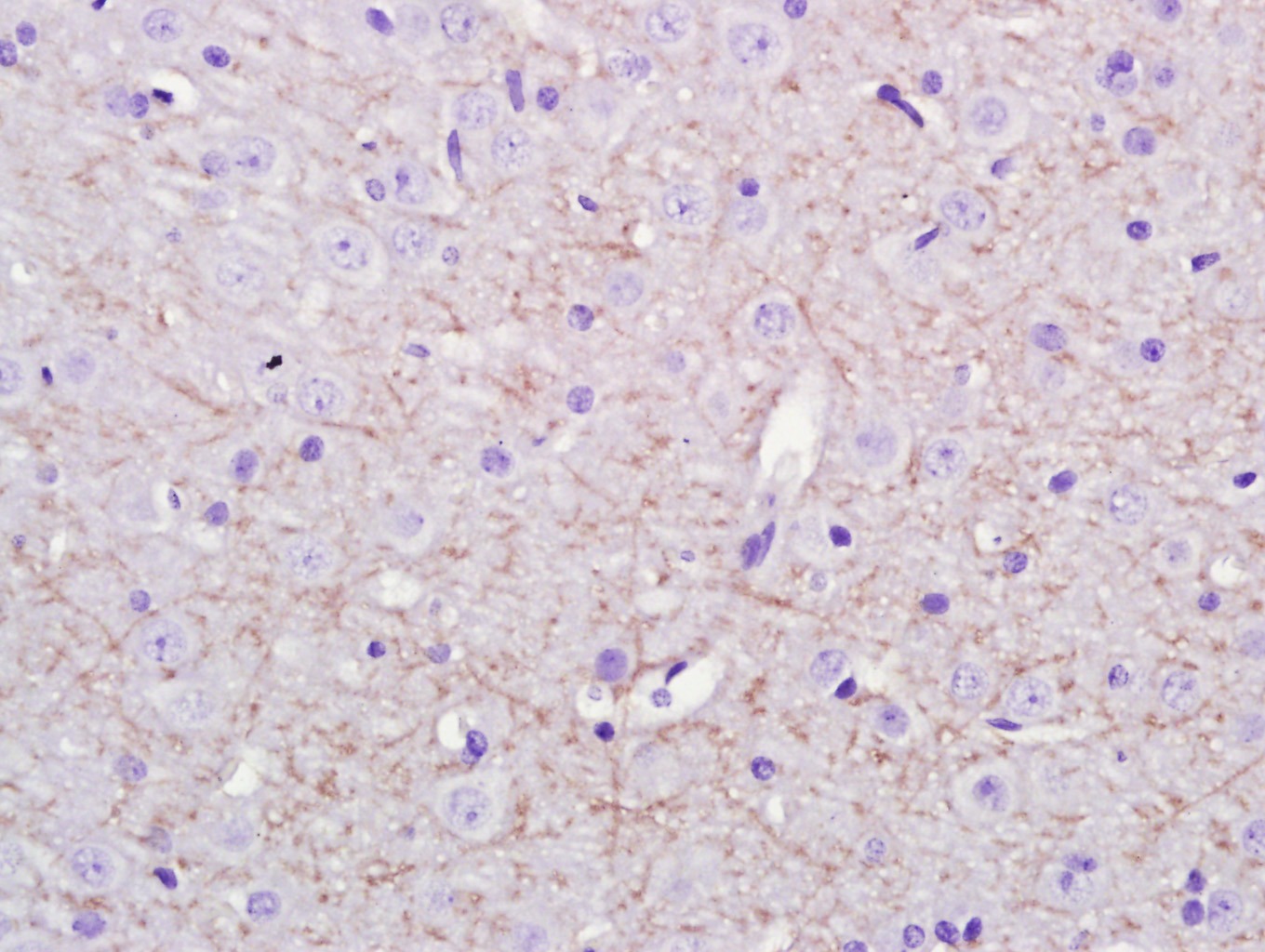 Anti-Notch 1 Polyclonal Antibody