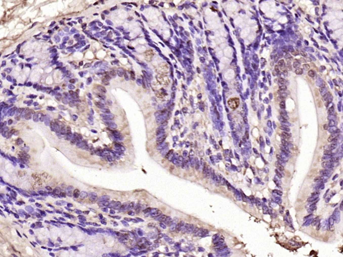 Anti-Notch 1 Polyclonal Antibody