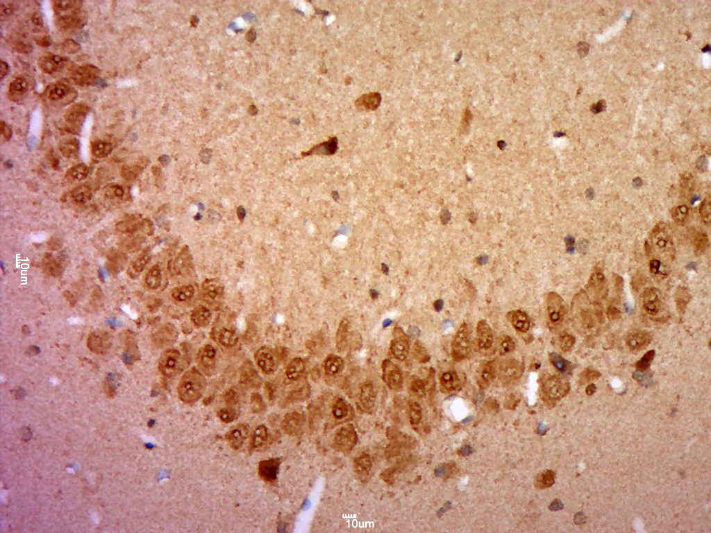 Anti-NPAS2 Polyclonal Antibody