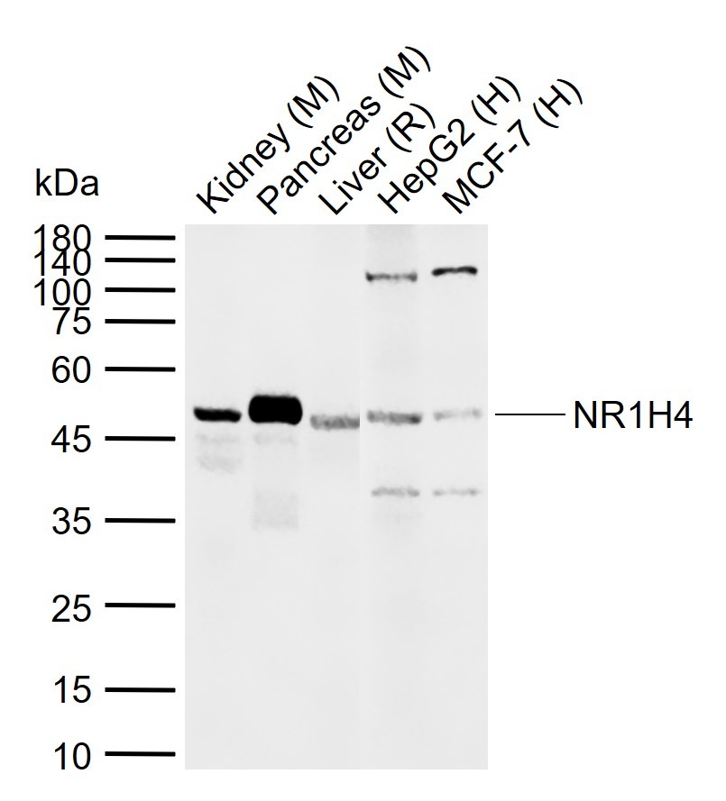 Anti-NR1H4 Polyclonal Antibody