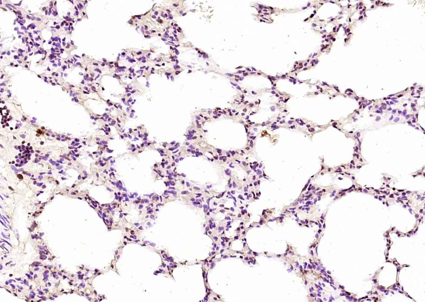 Anti-NR0B2 Polyclonal Antibody