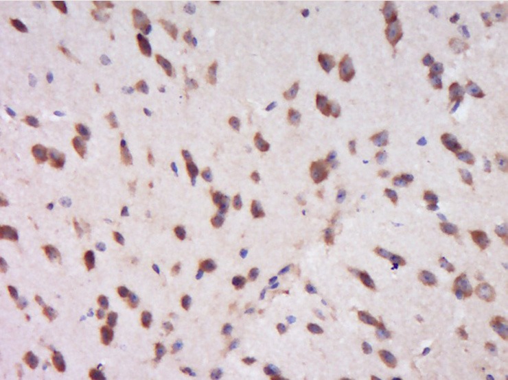 Anti-NR1D1 Polyclonal Antibody