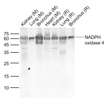 Anti-NOX4 Polyclonal Antibody