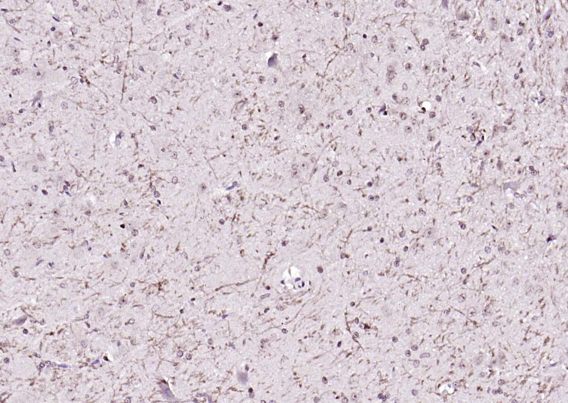 Anti-Notch 1 Polyclonal Antibody