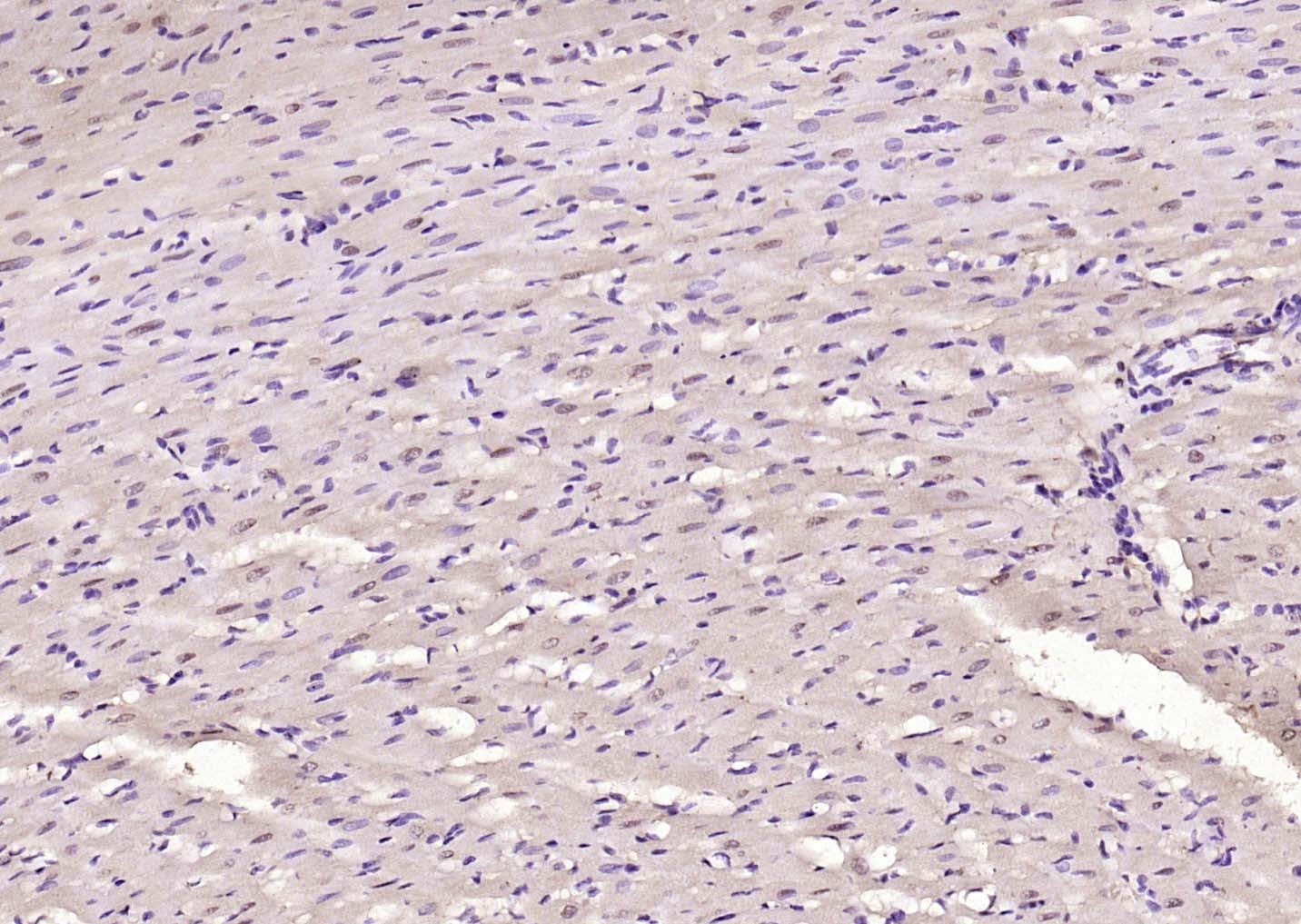 Anti-NOX4 Polyclonal Antibody