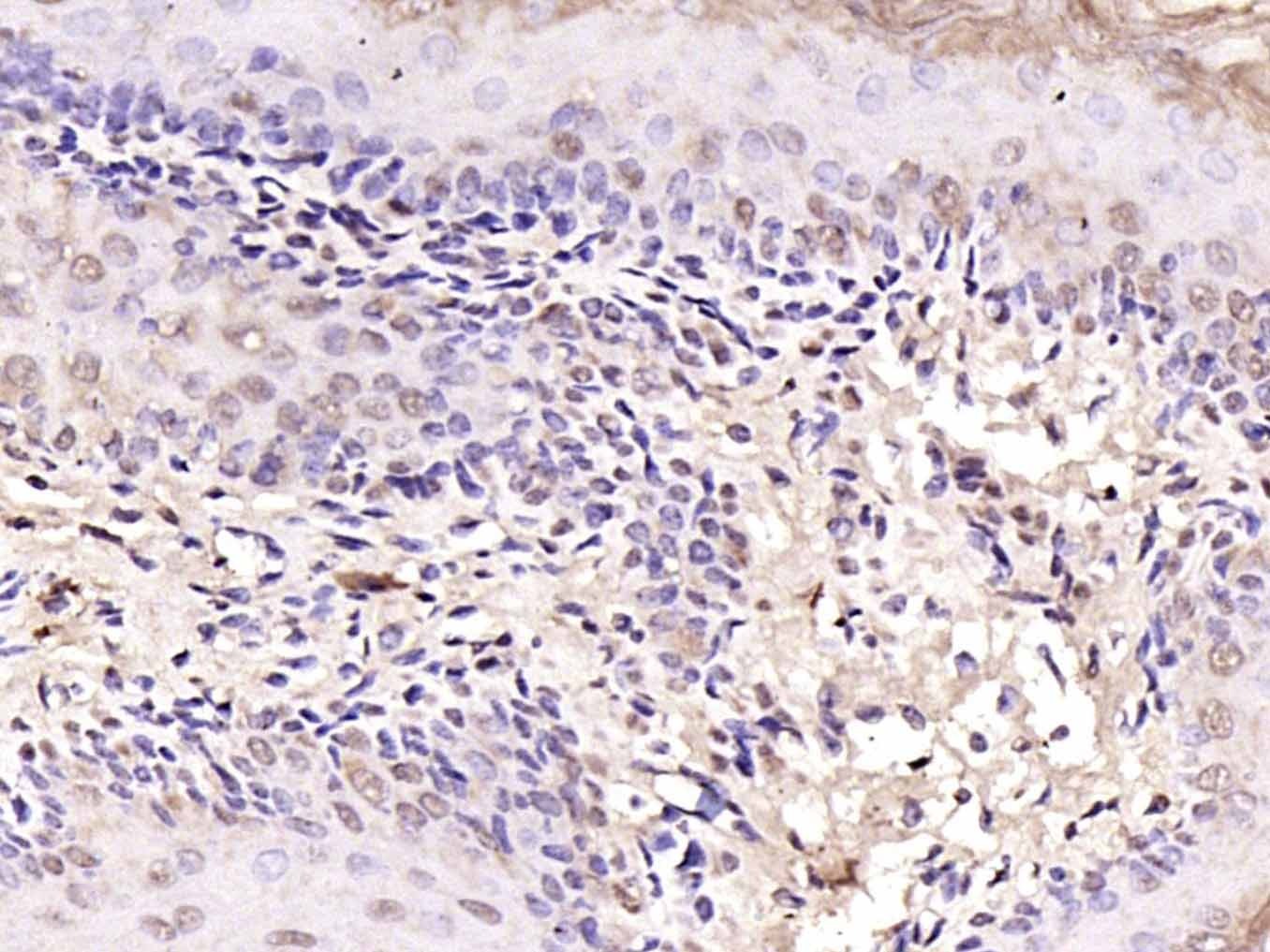 Anti-Notch 1 Polyclonal Antibody