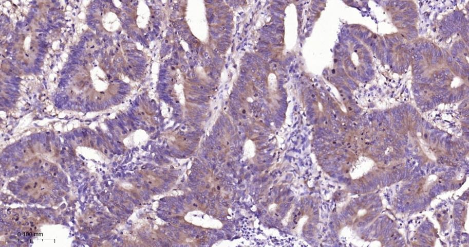 Anti-NF-kB p65 Antibody (5J938)