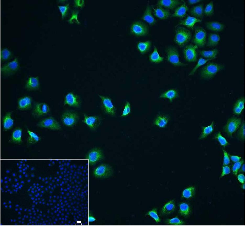 Anti-NF-kB p65 Antibody (9V807)