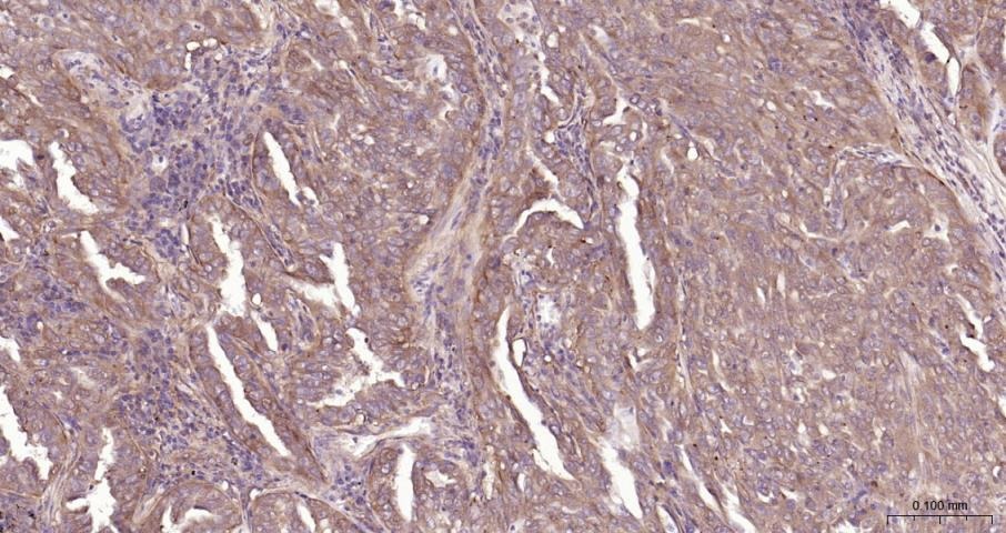 Anti-NF-kB p65 Polyclonal Antibody 3