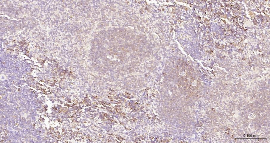 Anti-NF-kB p65 Polyclonal Antibody 3
