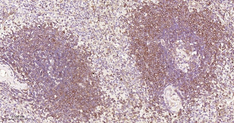 Anti-NF-kB p65 Antibody (5J938)
