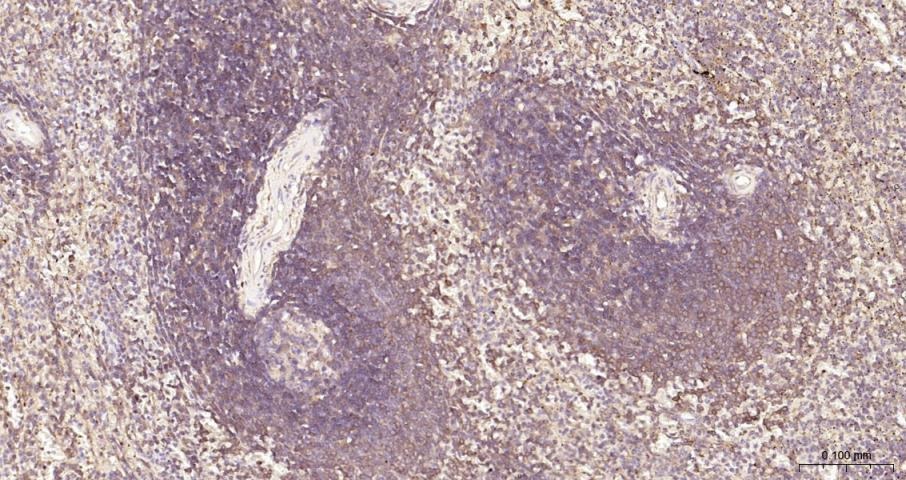 Anti-NF-kB p65 Polyclonal Antibody 3