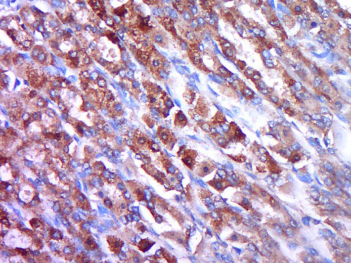 Anti-Osteoprotegerin Polyclonal Antibody 2