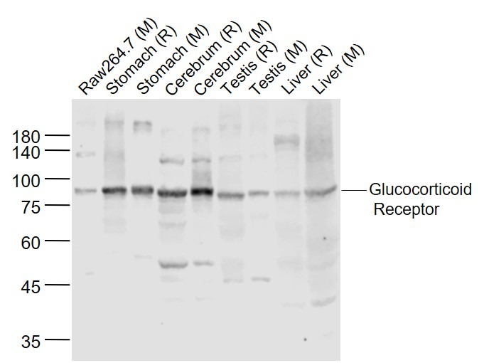 Anti-NR3C1 Polyclonal Antibody 2