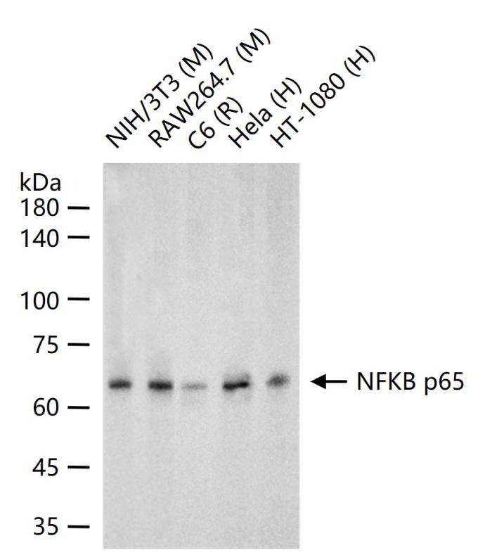 Anti-NF-kB p65 Antibody (9V807)