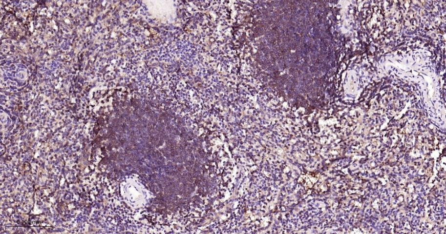 Anti-NF-kB p65 Antibody (9V807)