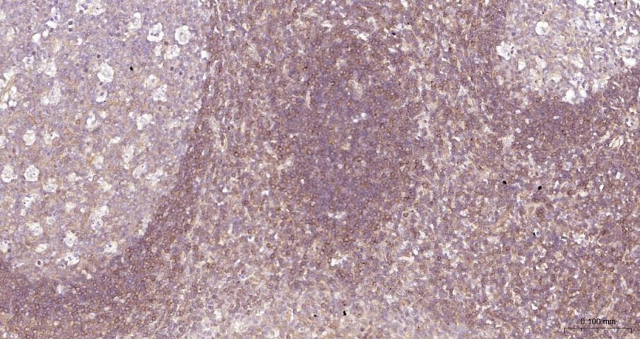 Anti-NF-kB p65 Polyclonal Antibody 3