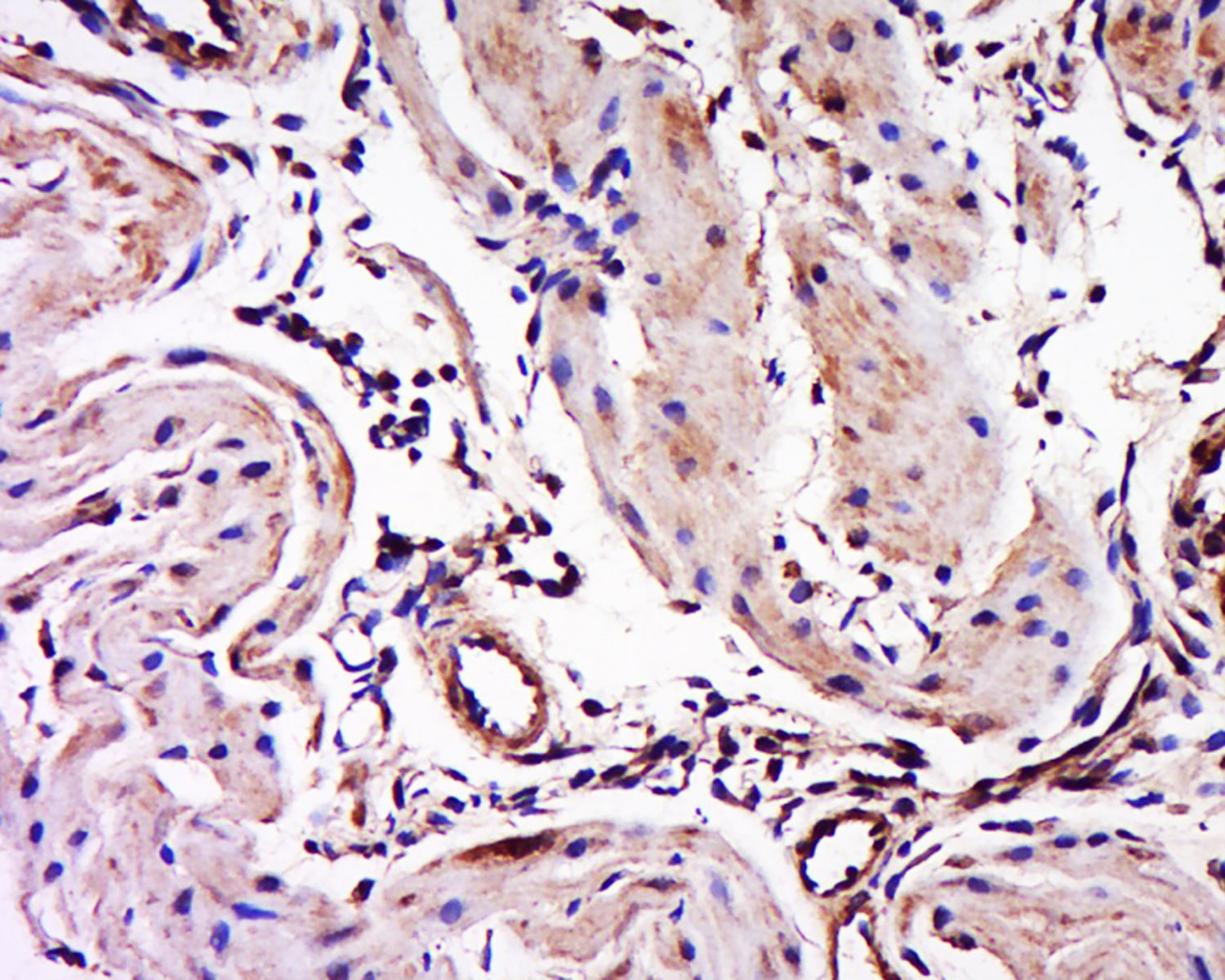 Anti-Myosin-3 Polyclonal Antibody