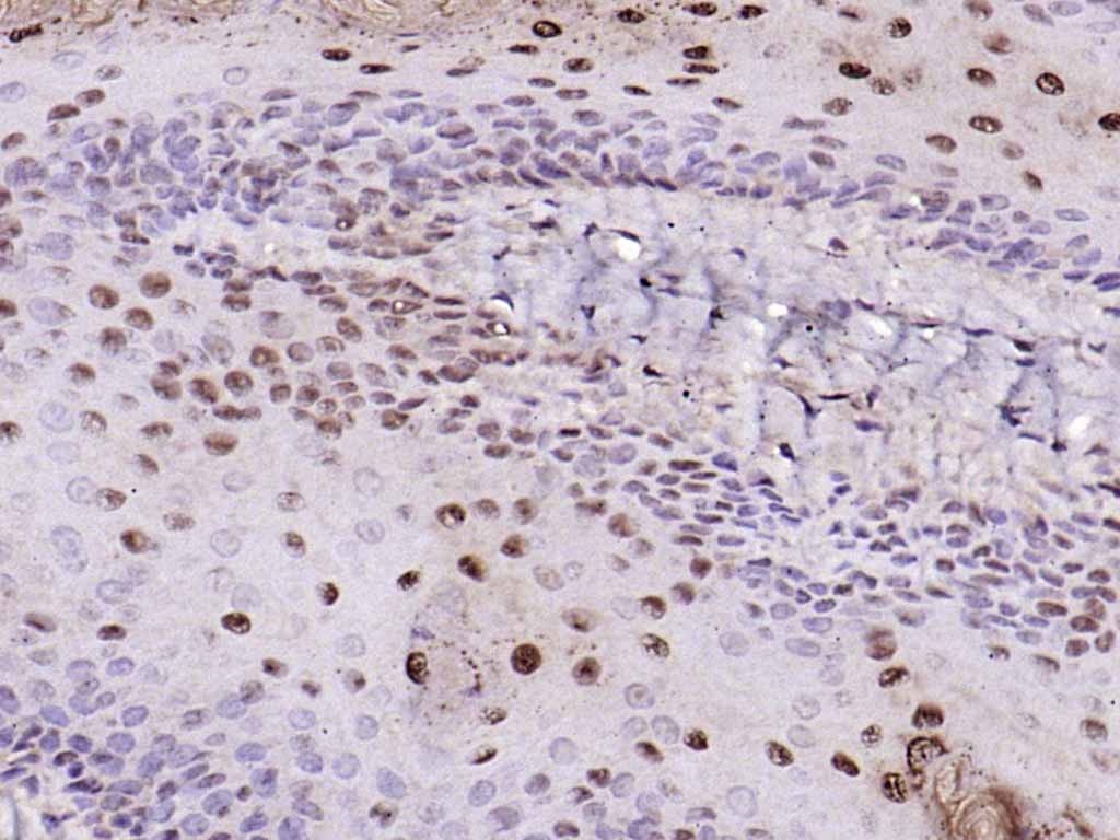 Anti-NR4A1 Polyclonal Antibody