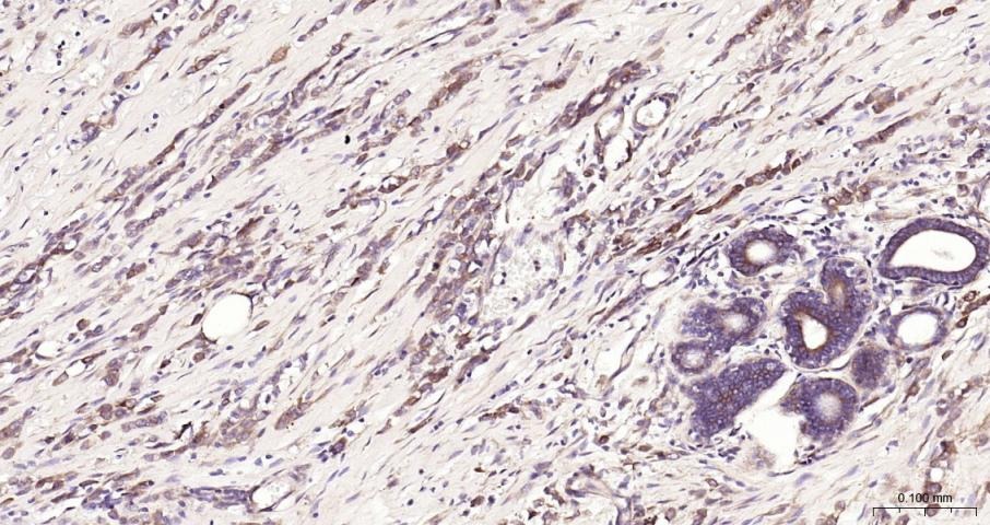 Anti-NF-kB p65 Polyclonal Antibody 3