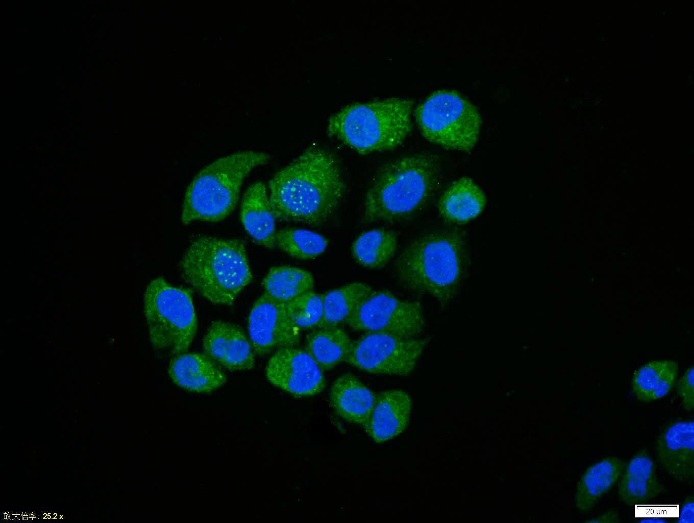 Anti-NF-kB p65 Polyclonal Antibody