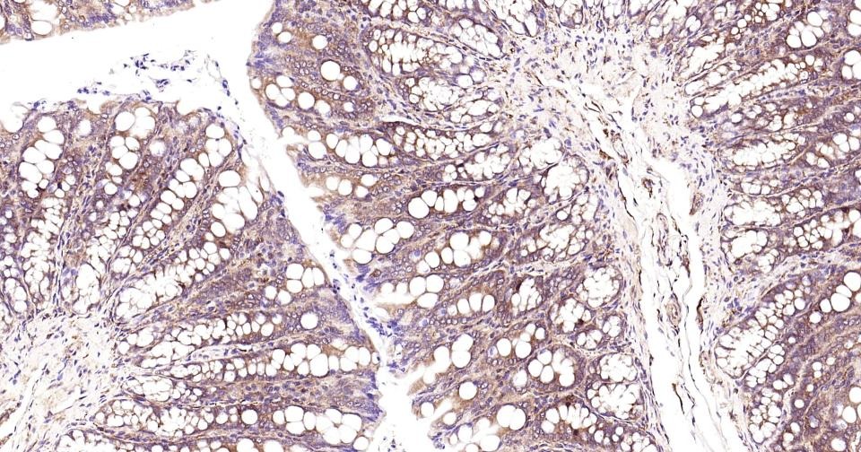 Anti-NF-kB p65 Antibody (2I809)