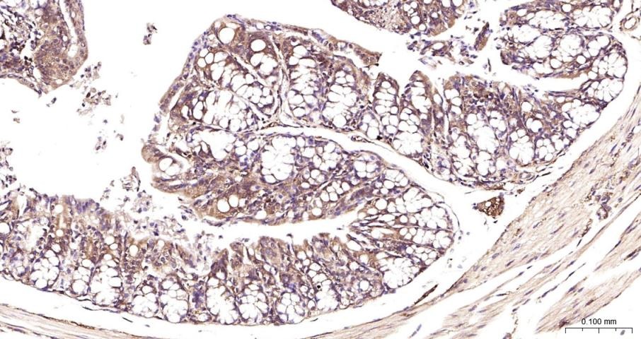 Anti-NF-kB p65 Polyclonal Antibody 3