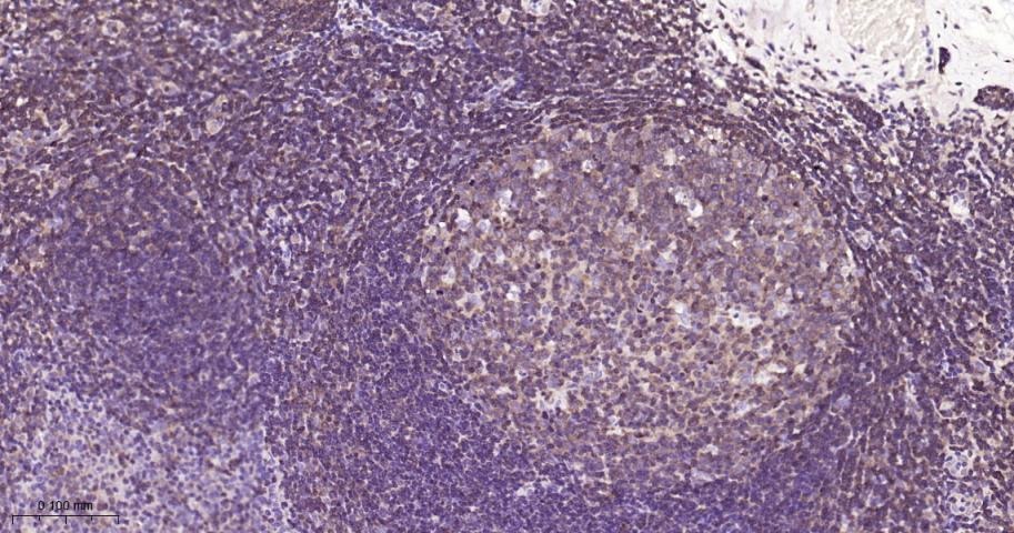 Anti-NF-kB p65 Antibody (9V807)