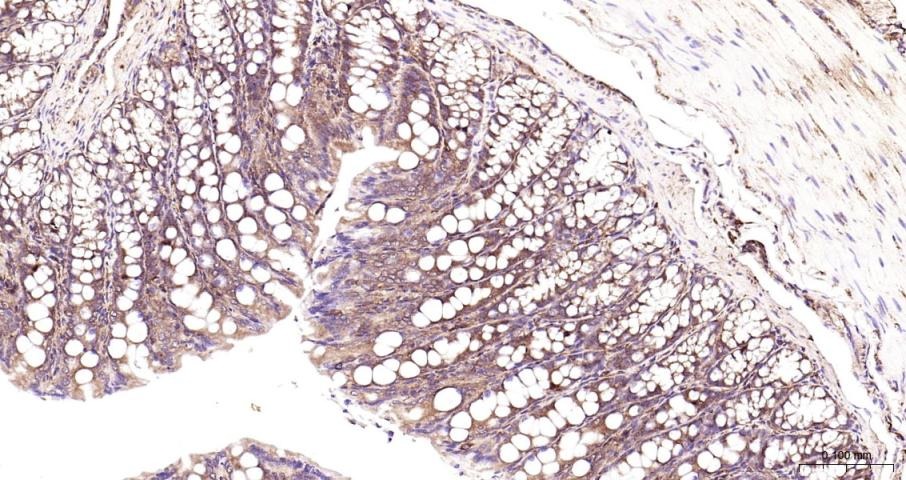 Anti-NF-kB p65 Polyclonal Antibody 3