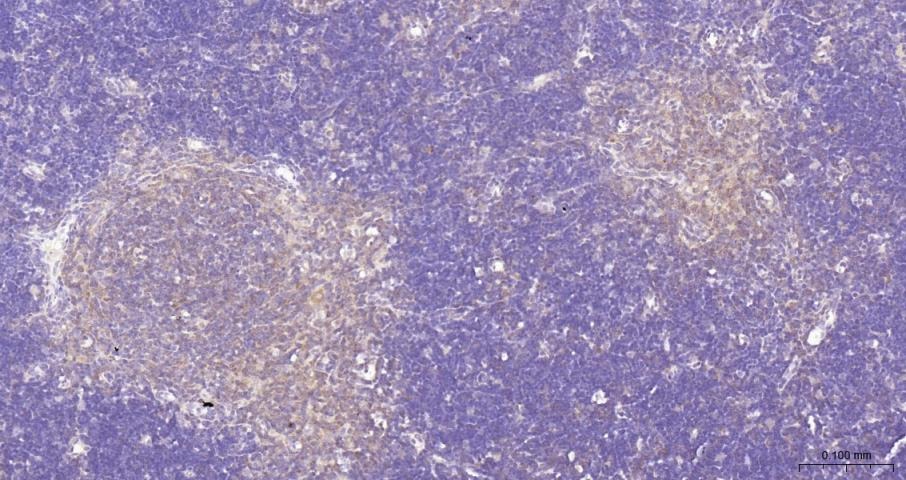 Anti-NF-kB p65 Polyclonal Antibody 3