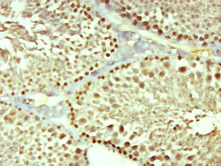 Anti-OTUD1 Polyclonal Antibody