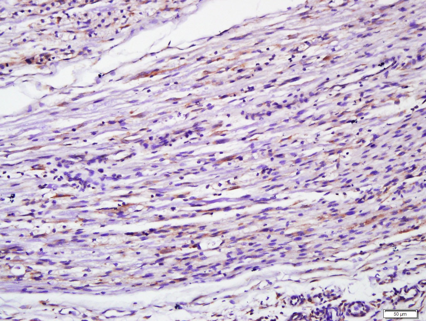 Anti-MYD88 Polyclonal Antibody