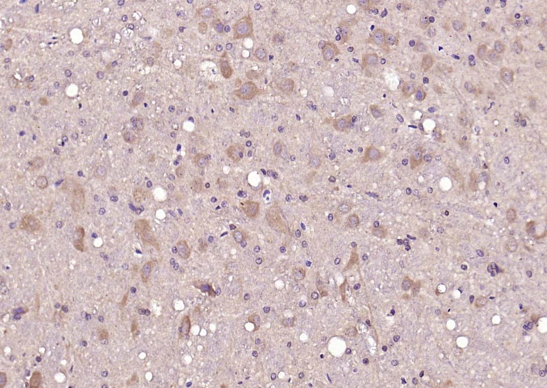 Anti-NR3C1 Polyclonal Antibody