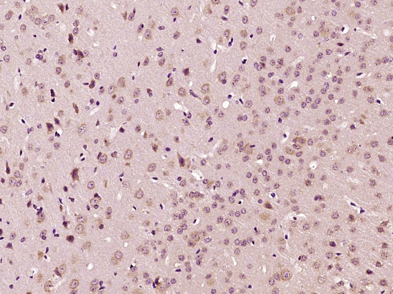 Anti-NR3C1 Polyclonal Antibody