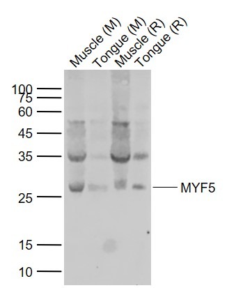 Anti-MYF5 Polyclonal Antibody