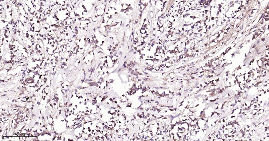 Anti-NF-kB p65 Antibody (9V807)