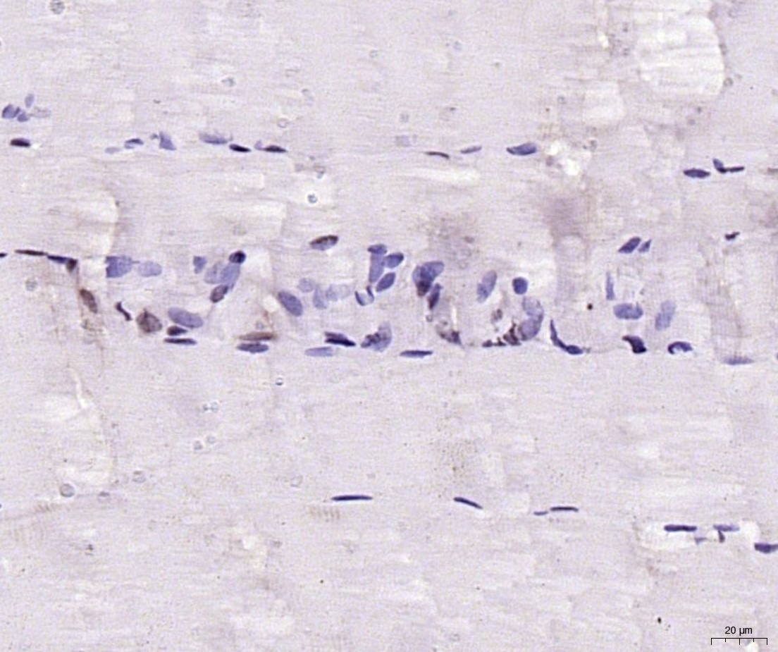 Anti-MYF5 Polyclonal Antibody