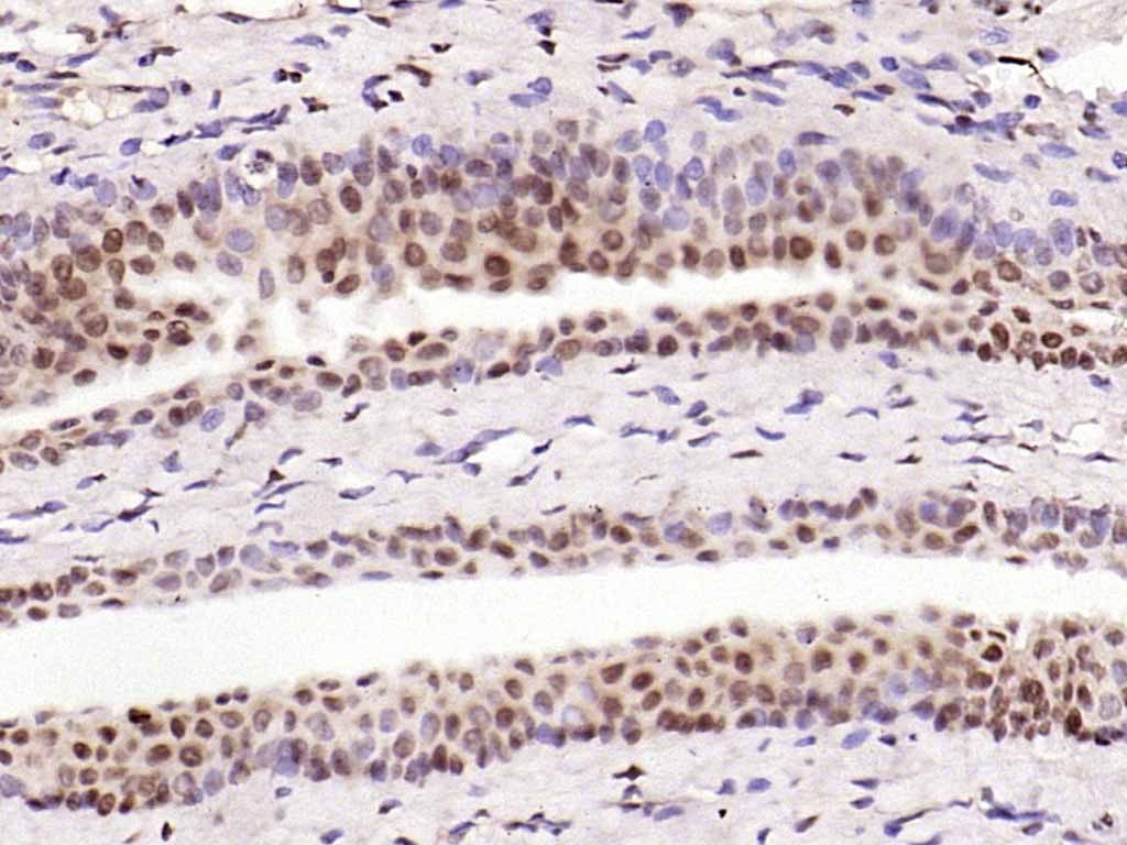 Anti-NFKB1 Polyclonal Antibody