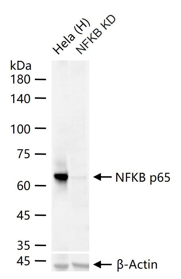 Anti-NF-kB p65 Antibody (2I809)