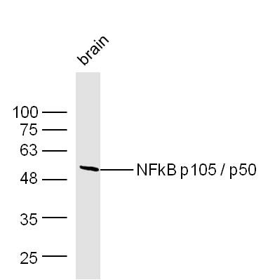 Anti-NFKB1 Polyclonal Antibody