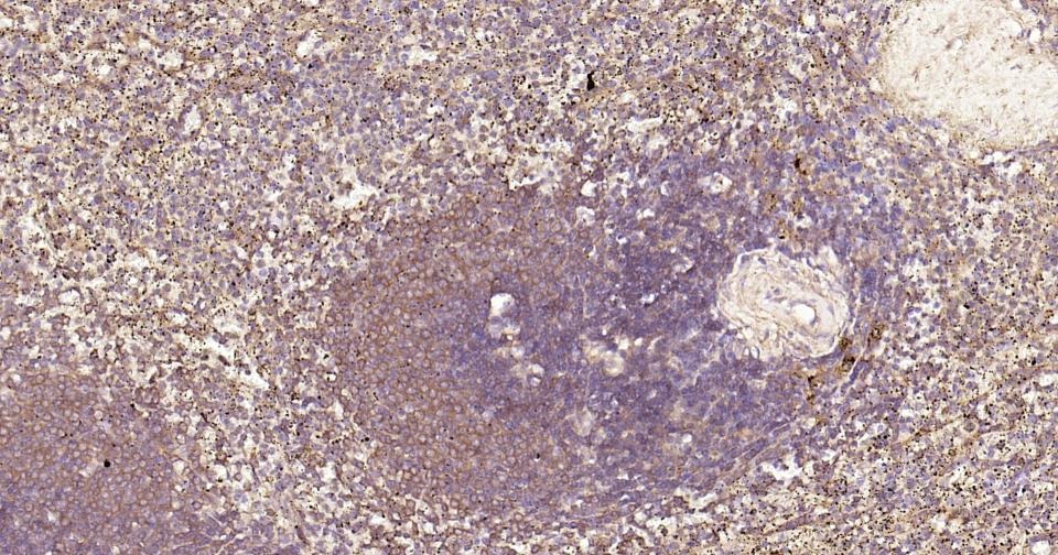 Anti-NF-kB p65 Antibody (2I809)