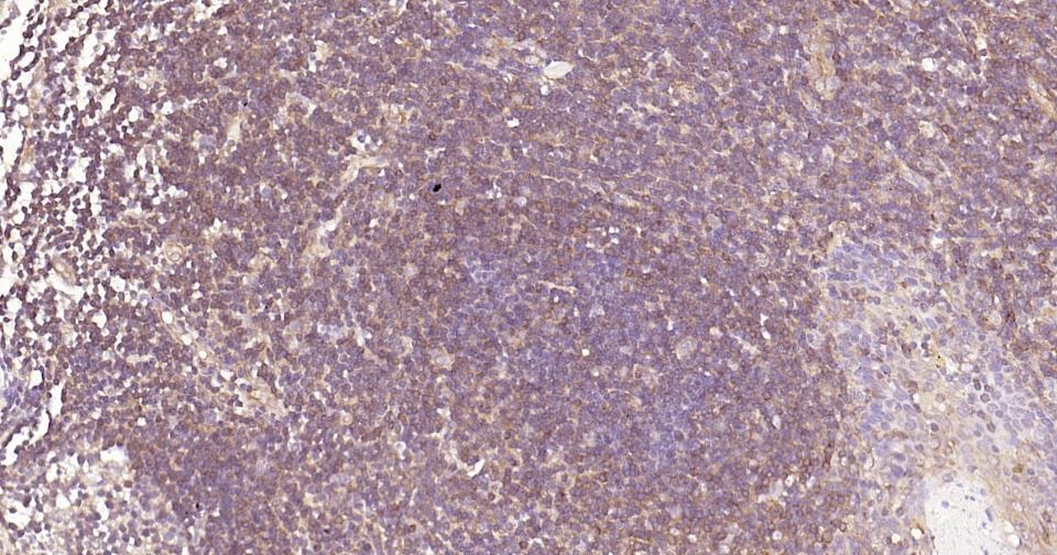 Anti-NF-kB p65 Antibody (2I809)