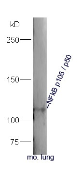 Anti-NFKB1 Polyclonal Antibody