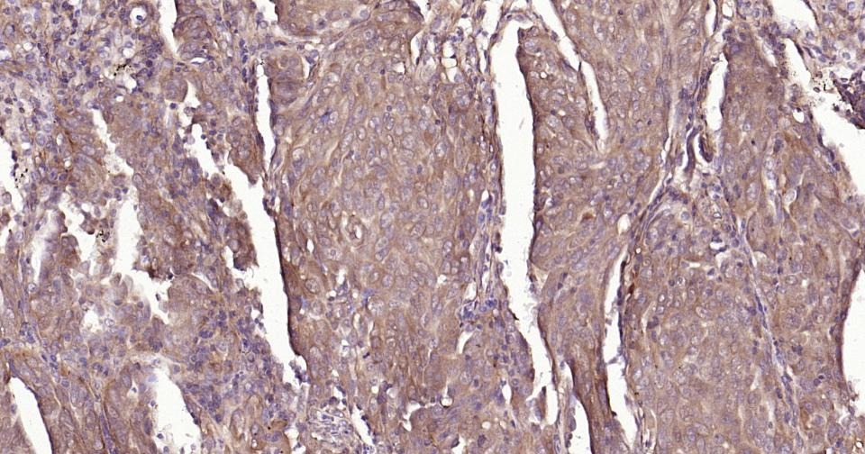 Anti-NF-kB p65 Antibody (2I809)
