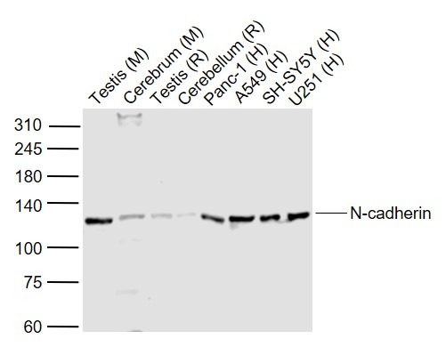 Anti-N Cadherin Polyclonal Antibody