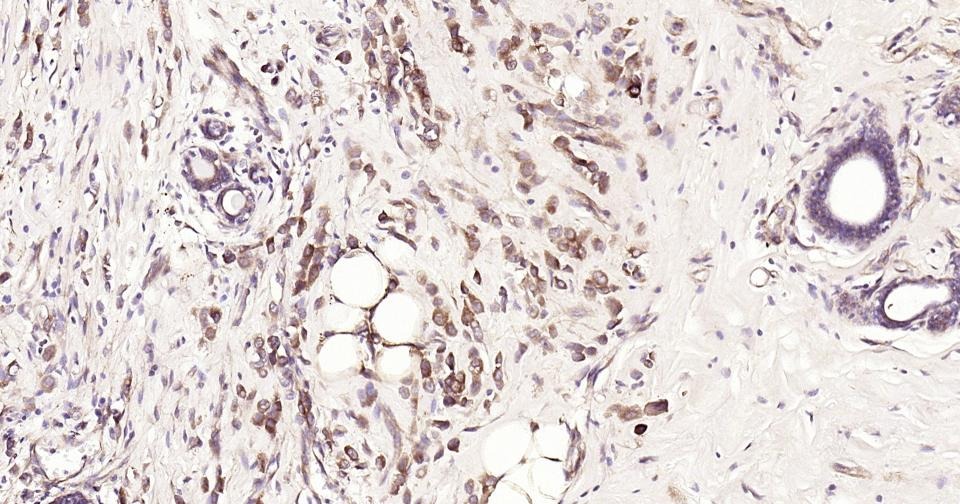 Anti-NF-kB p65 Antibody (2I809)