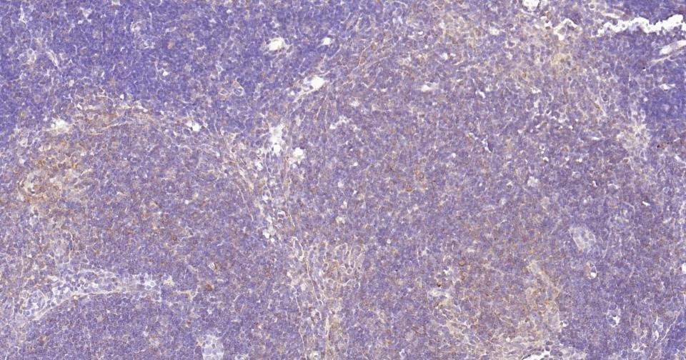 Anti-NF-kB p65 Antibody (2I809)