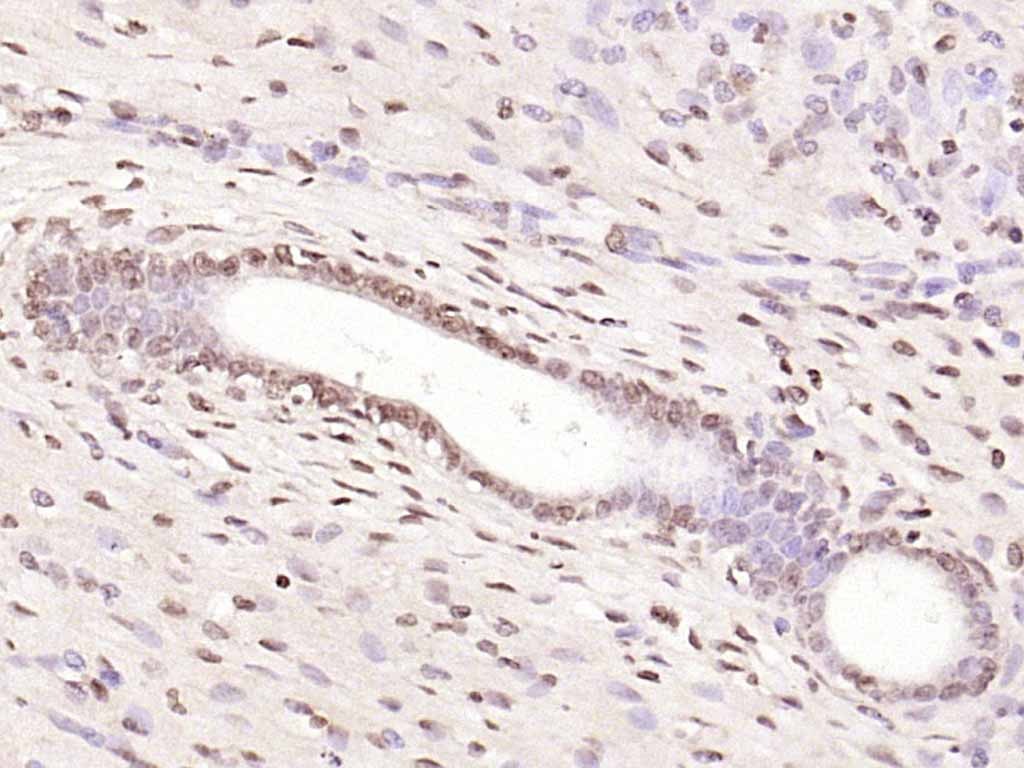 Anti-NFKB1 Polyclonal Antibody