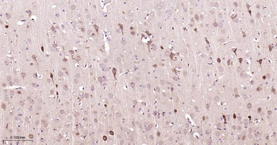 Anti-NGF Antibody (1M564)